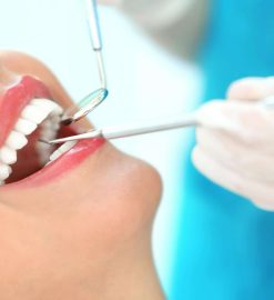 When Are Dental Veneers Recommended?