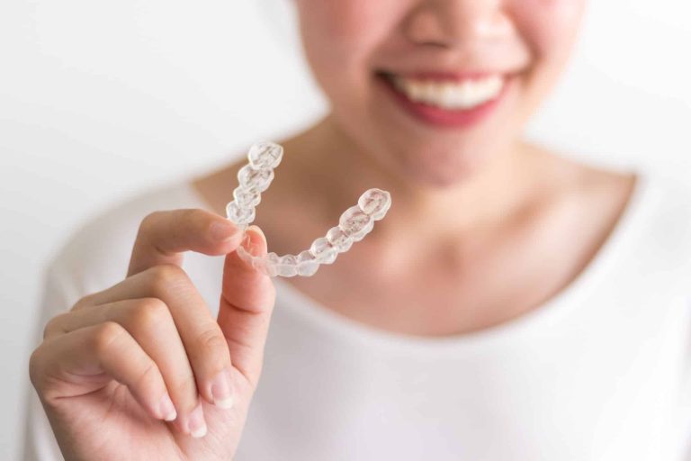 Invisalign Dentist San Diego